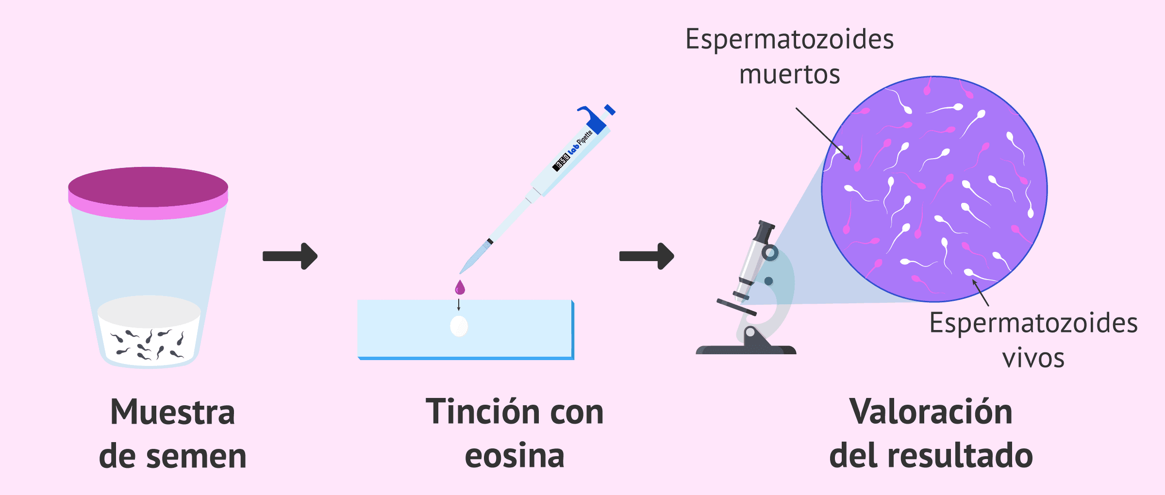 Prueba De Vitalidad Espermatozoides Inm Viles Vivos O Muertos