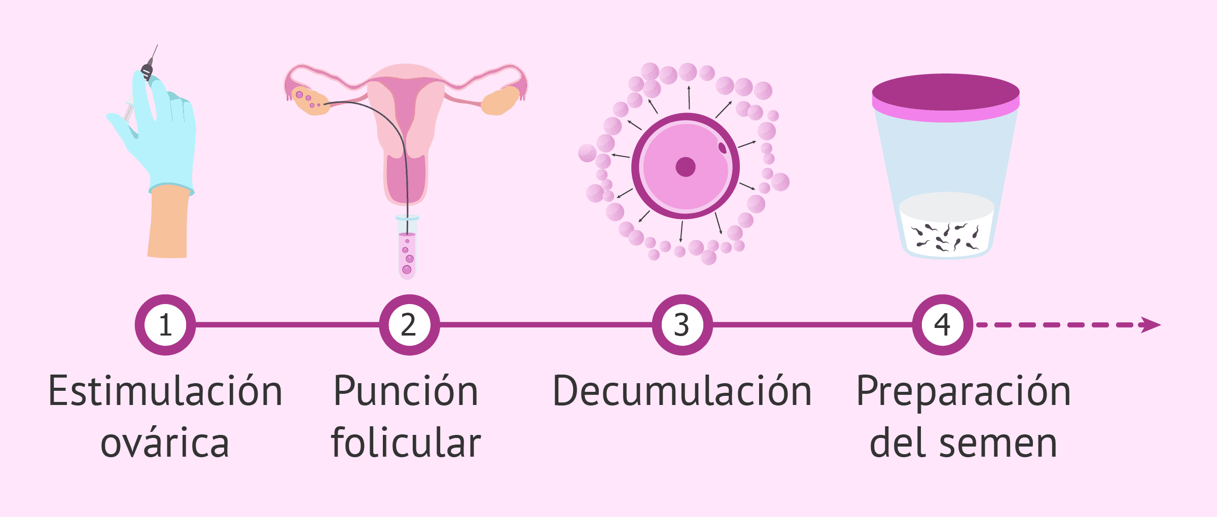 Etapas Del Proceso De La Icsi