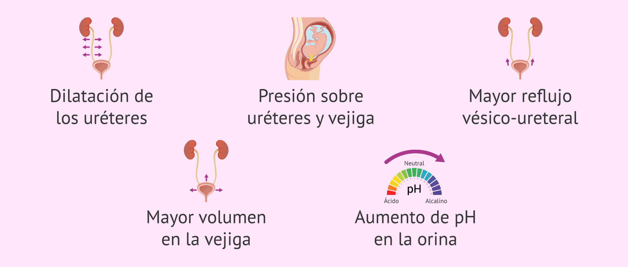 Causas que favorecen la infección de orina en el embarazo