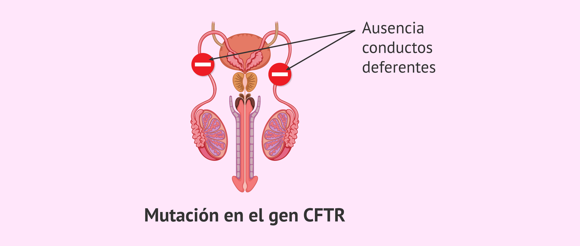 Fibrosis Qu Stica