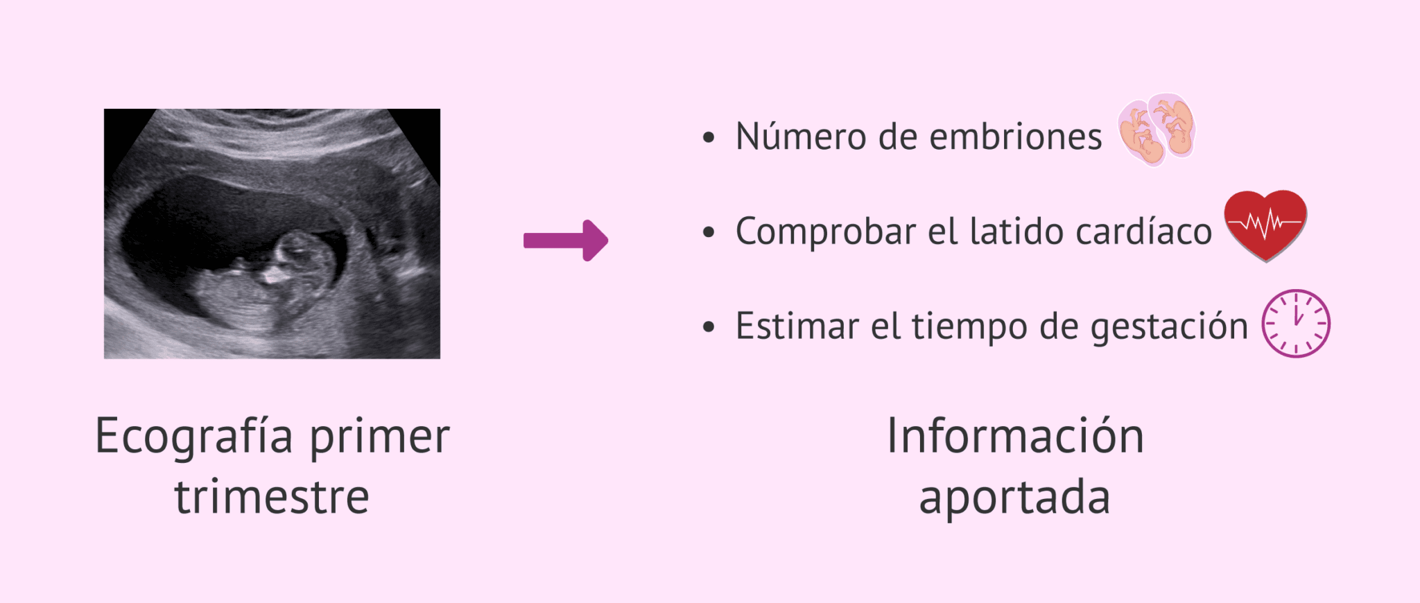 Qu Informaci N Aporta La Ecograf A De La Semana De Embarazo