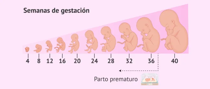 grande para las complicaciones de la edad gestacional