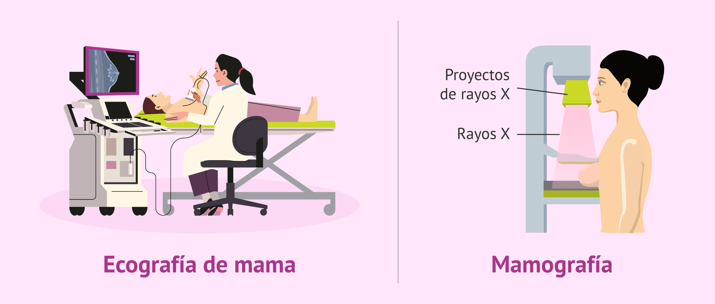 Imagen: Ecografía de mama y mamografía