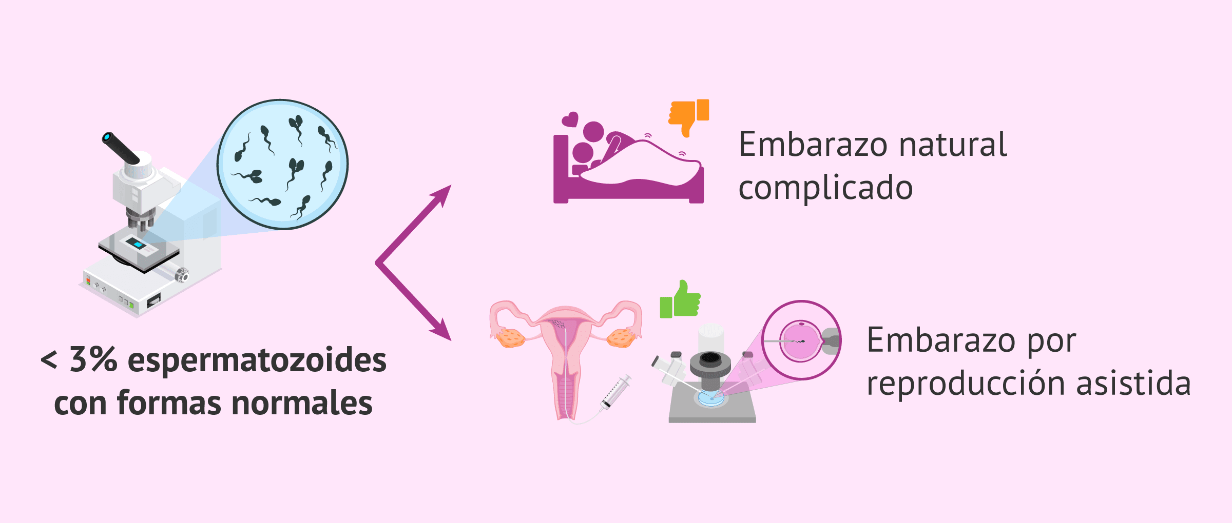 Imagen: Opciones de embarazo con un 3% de espermatozoides normales