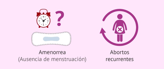 El útero Infantil Causas Diagnóstico Y Posibilidad De Embarazo