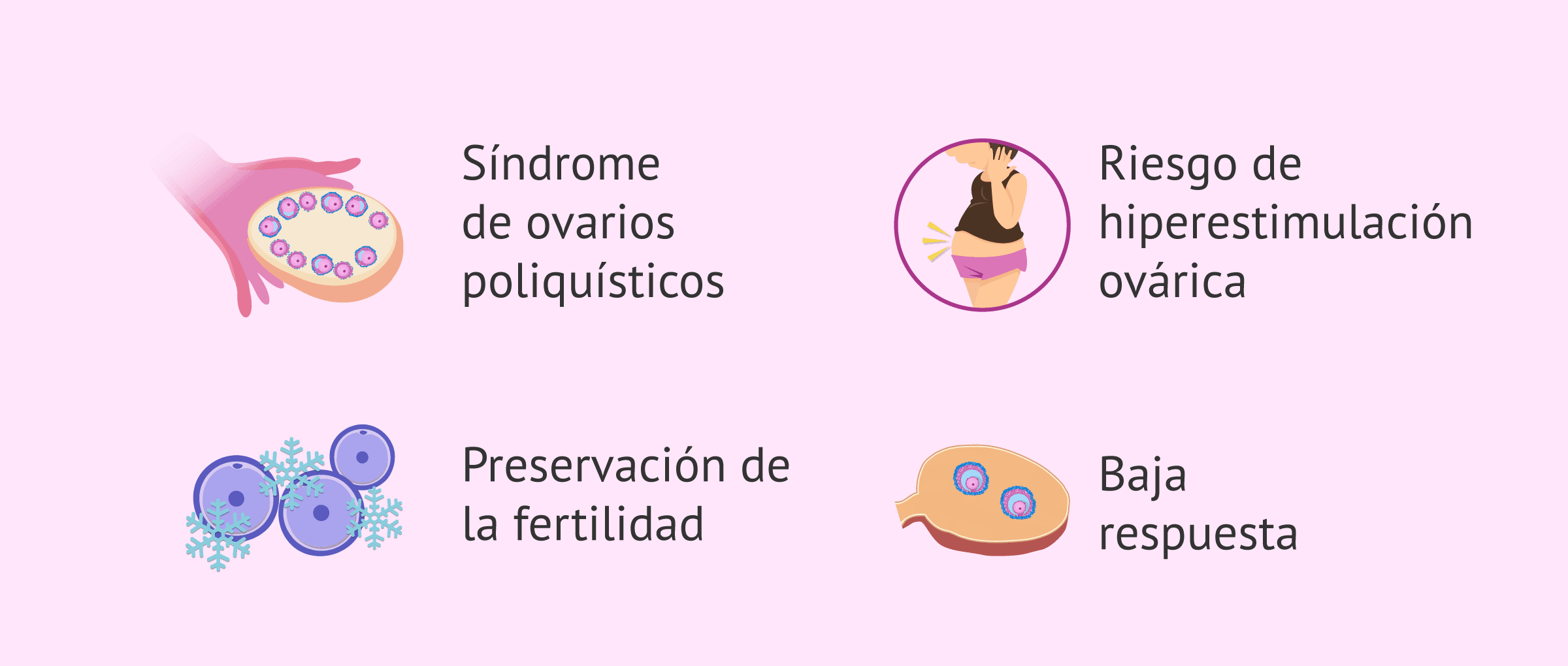 Indicaciones de la maduración in vitro (IVM)