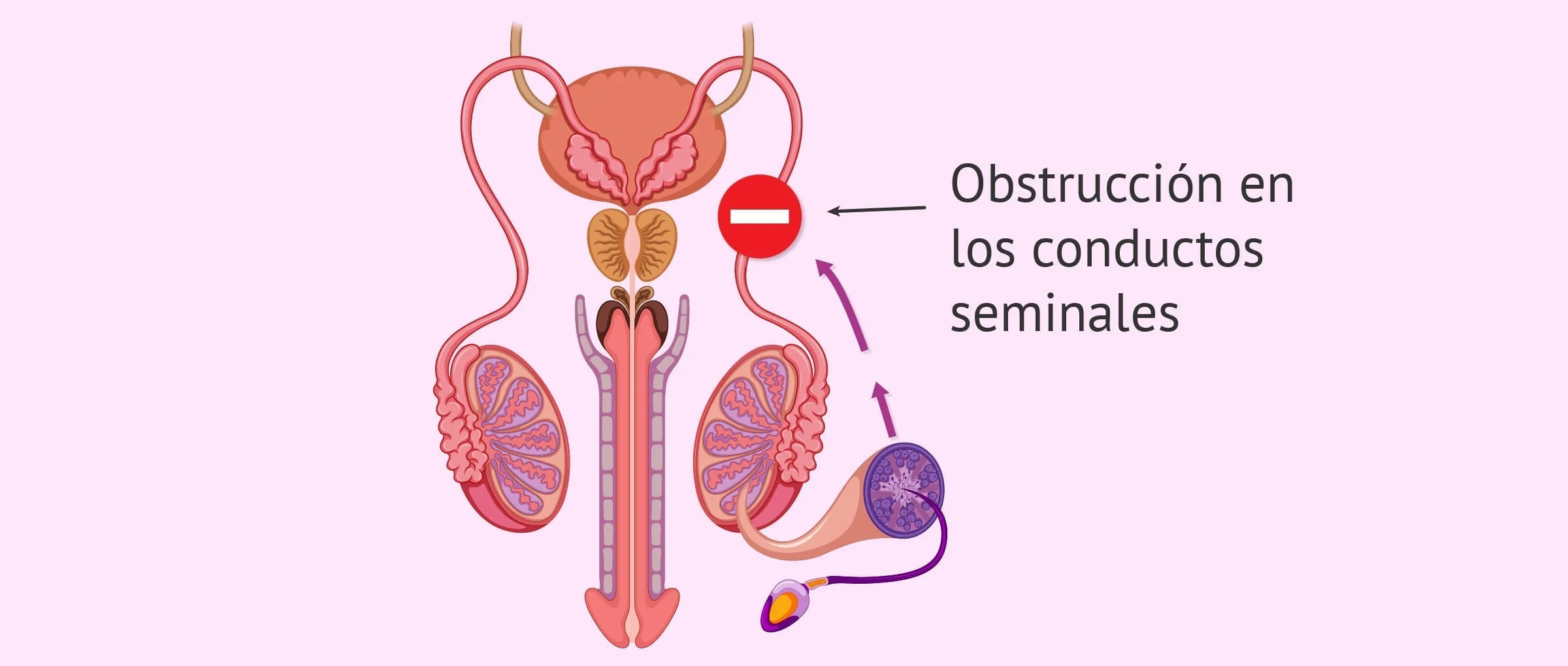 Factor postesticular