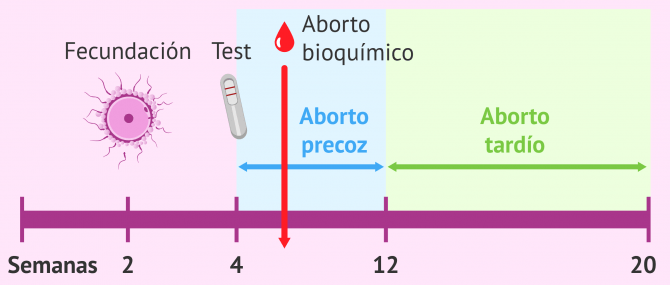 Imagen: aborto espontáneo