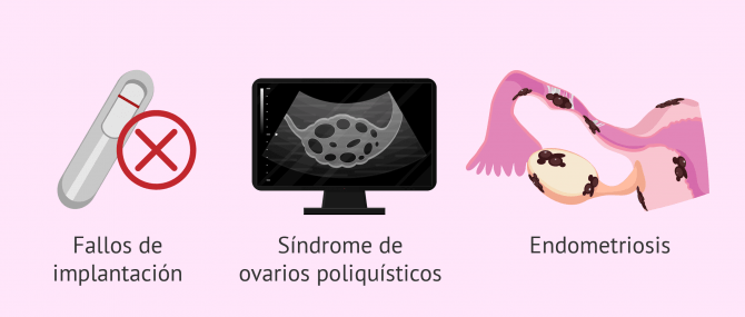 Imagen: Mejorar la fertilidad con acupuntura