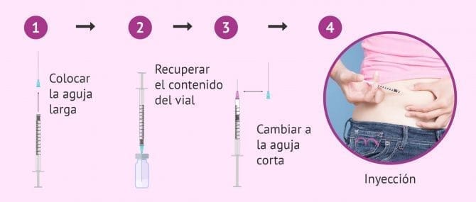 Imagen: Aplicación de la inyección de Puregon