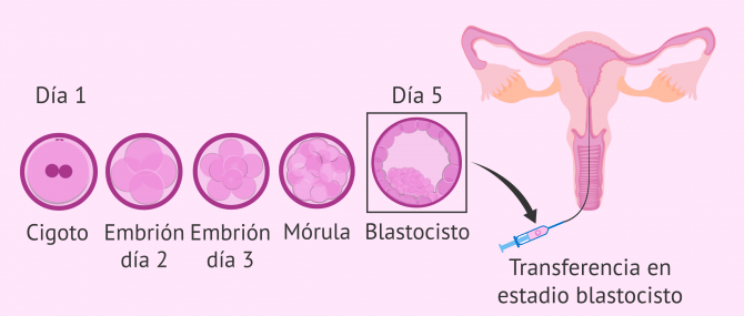 Imagen: Implantación correcta