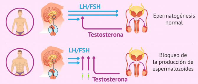 Imagen: La testosterona en exceso reduce el volumen testicular