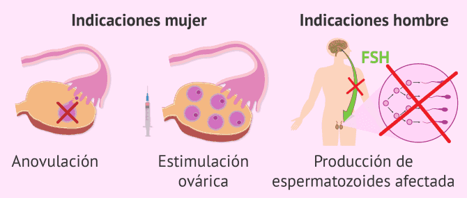 Imagen: Indicaciones de Puregon en mujeres y hombres