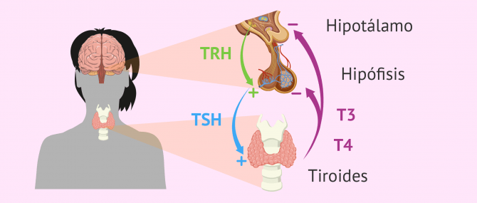 Imagen: Problemas de tiroidismo