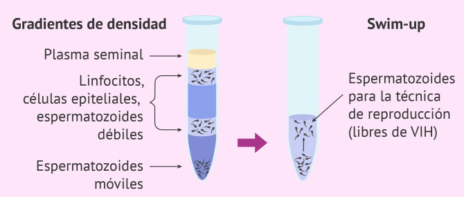 Imagen: Semen con VIH