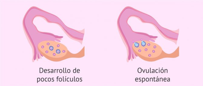 Imagen: Controles ecográficos en estimulación ovárica