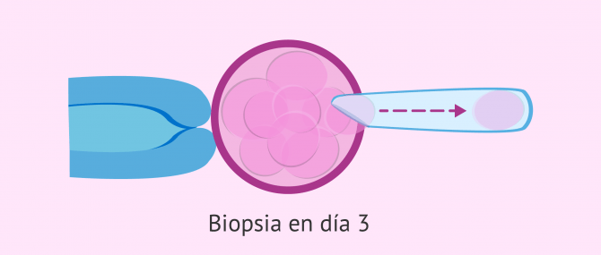 Imagen: Biopsia en día 3 para DGP