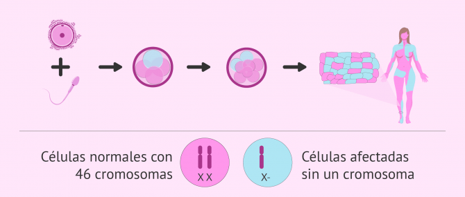 Imagen: Enfermedad cromosómica