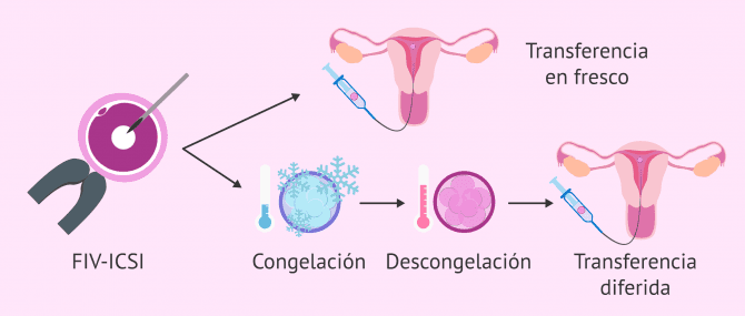 Imagen: Transfer de conges