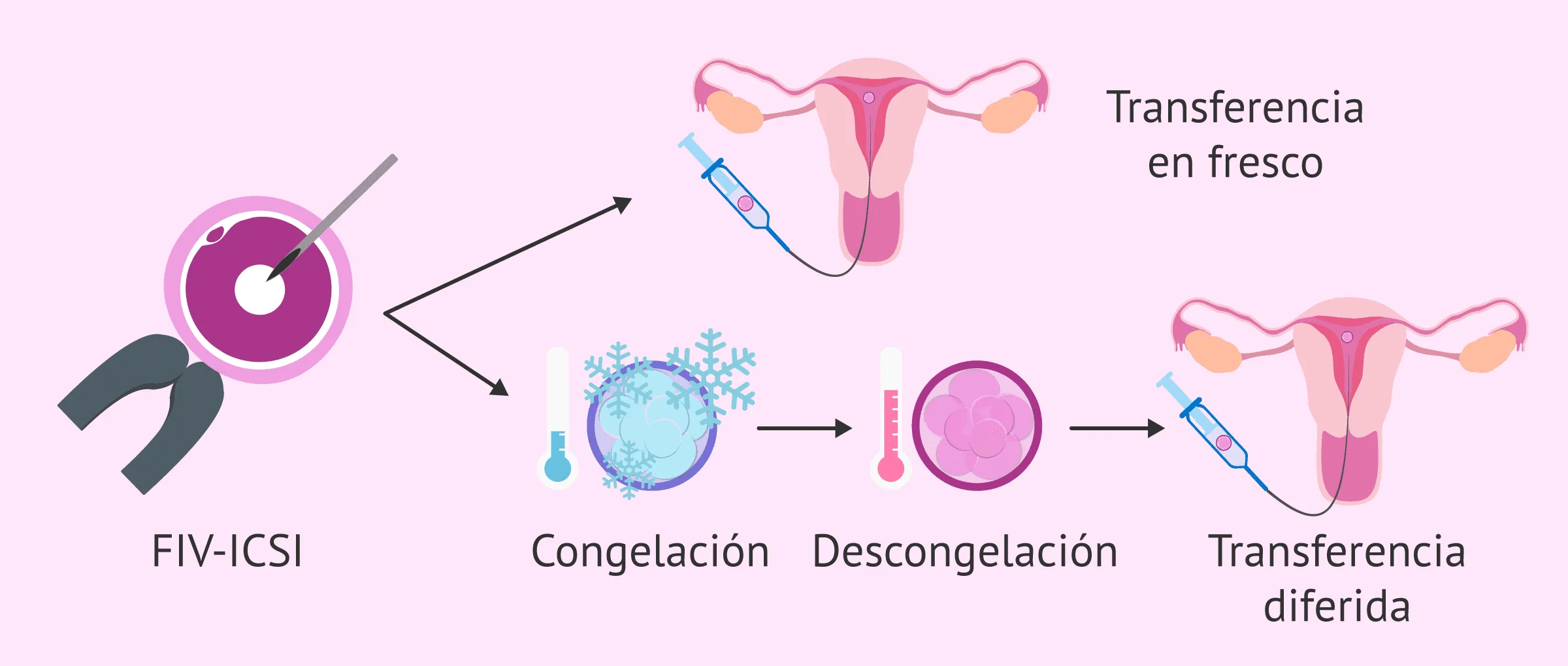 Transferencia en fresco vs. transferencia de congelados