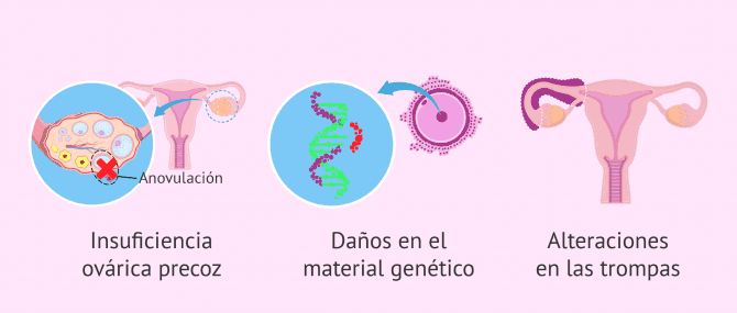 Imagen: Alteraciones en la mujer tras el tratamiento oncológico