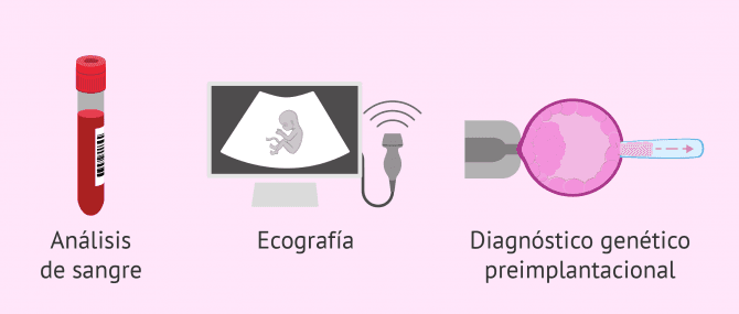 Imagen: Salud del bebé y amniocentesis