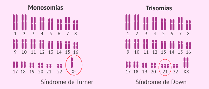 Imagen: Tipos de aneuploidias compatibles con la vida