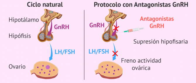 Imagen: Fisiología de los antagonistas de la GnRH