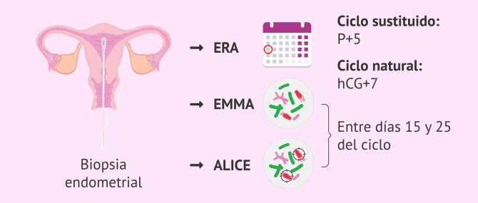 Imagen: ¿Cuándo hacer la biopsia para el test EndomeTRIO?