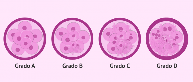 Imagen: Los embriones de FIV se clasifican en grados en función de su calidad embrionaria