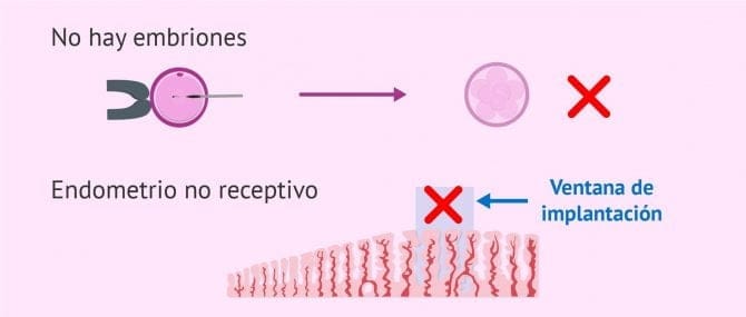 Imagen: Cancelación de la transferencia de embriones