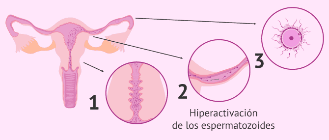 Imagen: Capacitación espermática natural