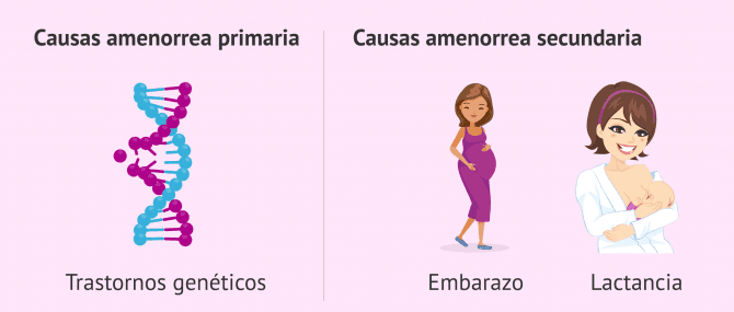 Imagen: Causas primarias y secundarias de la amenorrea