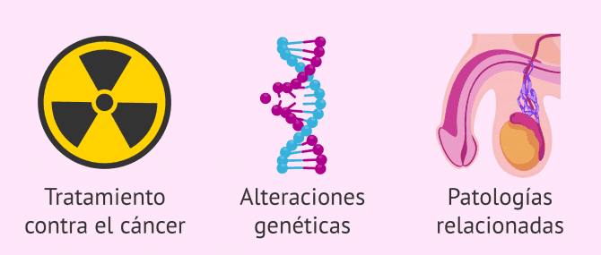 Imagen: Causas irreversibles de teratozoospermia