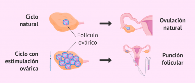 Imagen: Ciclo natural y ciclo estimulado en la mujer