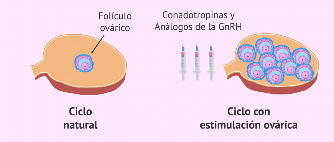 Imagen: Ciclo natural y ciclo con estimulación ovárica controlada