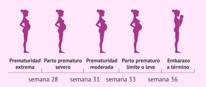 Imagen: Prmaturidad del parto en función de la semana en la que ocurra