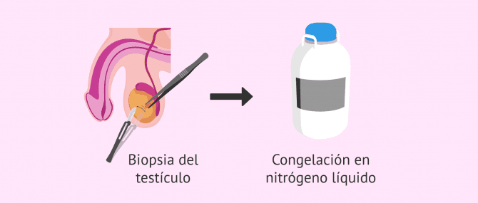 Imagen: Proceso para la congelación de tejido testicular