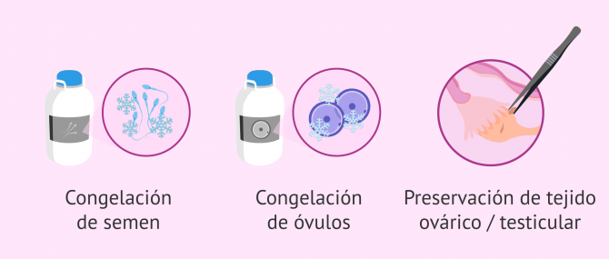 Imagen: Criopreservación de espermatozoides