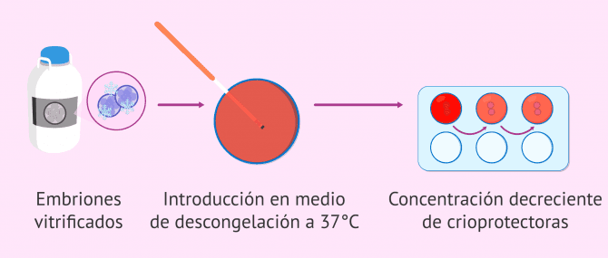 Imagen: Proceso de desvitrificación de embriones