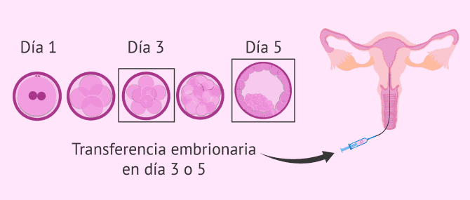 Imagen: Cuándo hacer una transferencia embrionaria