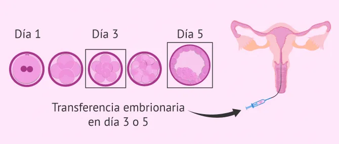 Cuando hacer la transferencia de embriones En dia 3 o en dia 5