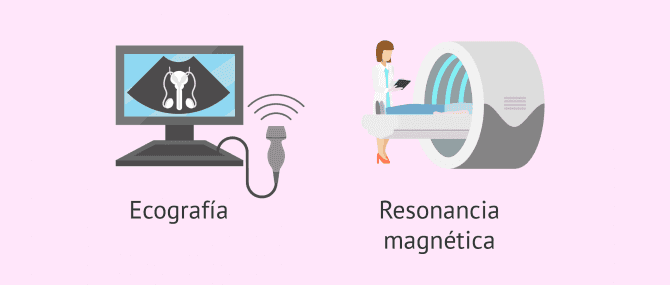 Imagen: Cómo se diagnostica la criptorquidia