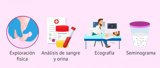 Imagen: Pruebas diagnósticas para la epididimitis