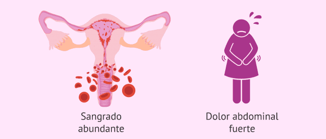 Imagen: Síntomas graves tras la transferencia embrionaria