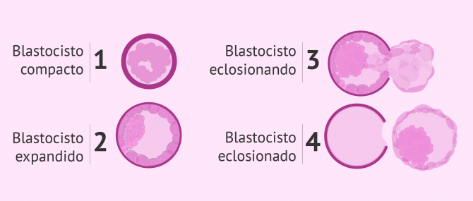 Imagen: Hatching asistido