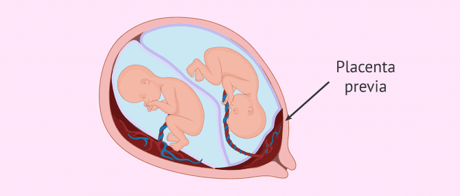 Imagen: Bebés más pequeños