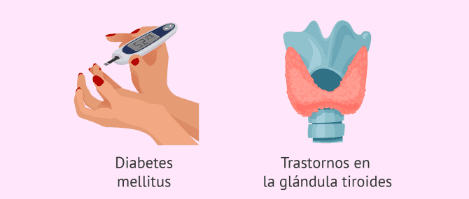 Imagen: Enfermedades endocrinas en el embarazo