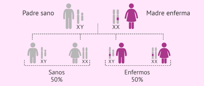 Imagen: Herencia de enfermedades ligadas al cromosoma X dominantes