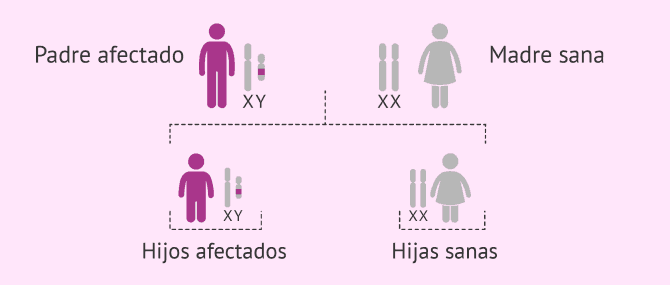 Imagen: Herencia de enfermedades ligadas al cromosoma Y